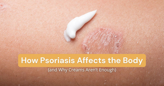 How Psoriasis Affects the Body (and Why Creams Aren’t Enough)